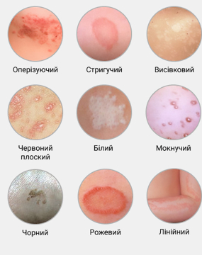 Лишаї