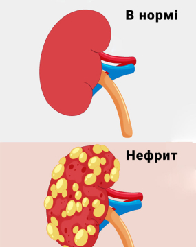 Нефрит