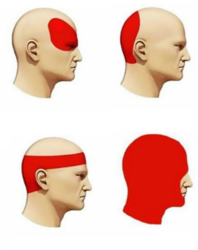 Головний біль